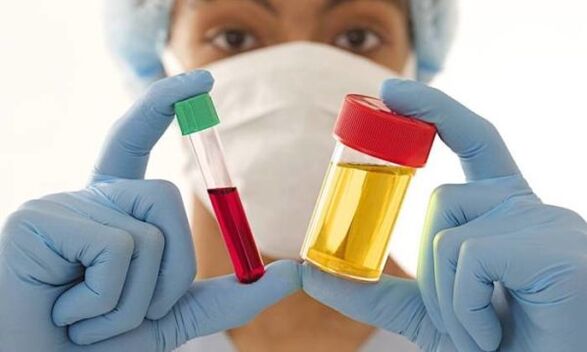 esami del sangue e delle urine prima dell'intervento di mastoplastica additiva