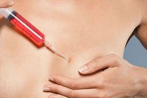 iniezione al seno per aumentare il grasso